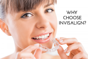Why Choose Invisalign?